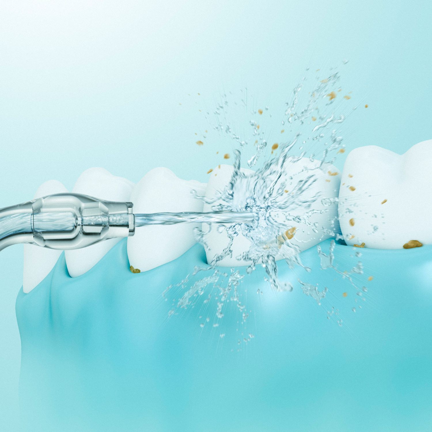 Ретельне очищення зубів за допомогою ультразвукової технології