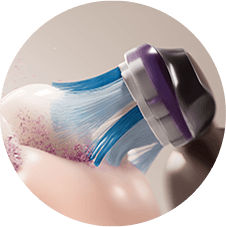 Крупний план зубної щітки, яка видаляє пошкоджений зубний наліт із зубів.